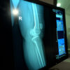 Priorizar el área de radiología era uno de los pilares del plan de inversiones dispuesto por Camcel