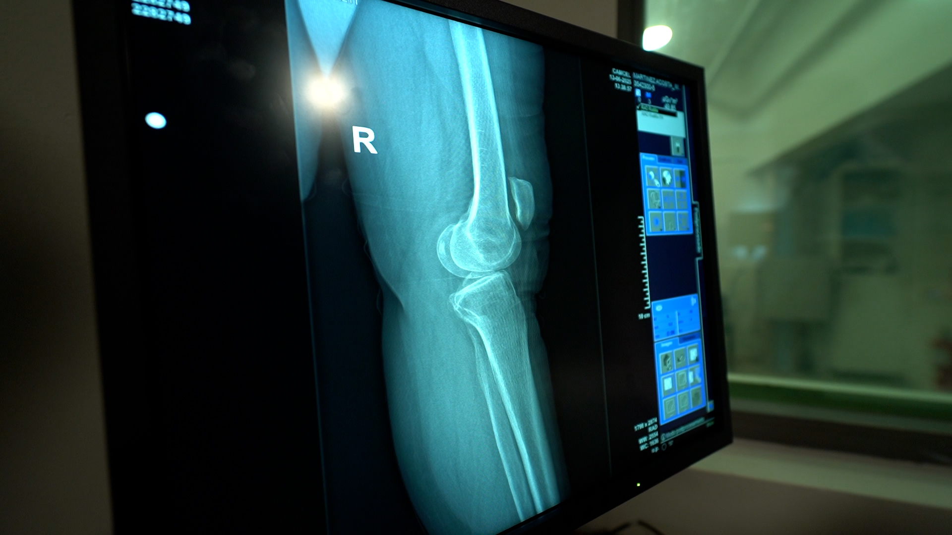 Priorizar el área de radiología era uno de los pilares del plan de inversiones dispuesto por Camcel